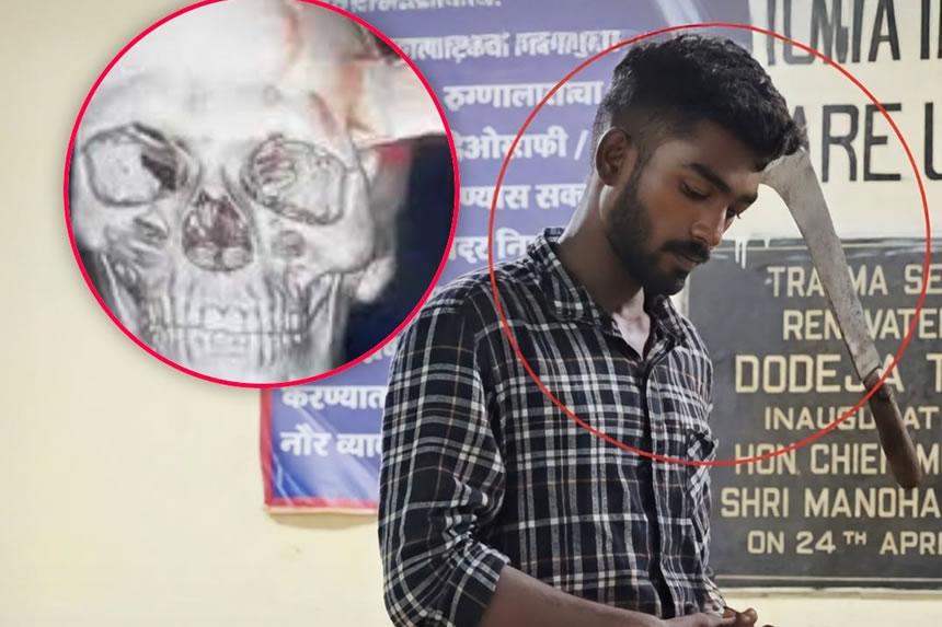 Akutwa Hospitali panga linaning'inia kichwani huku akichezea simu